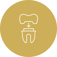 Veneers, Crowns and Bridges