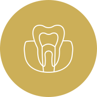 Root Canal Treatment